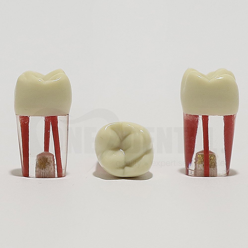Endo Tooth 16 (3 Canals) for ADC Model