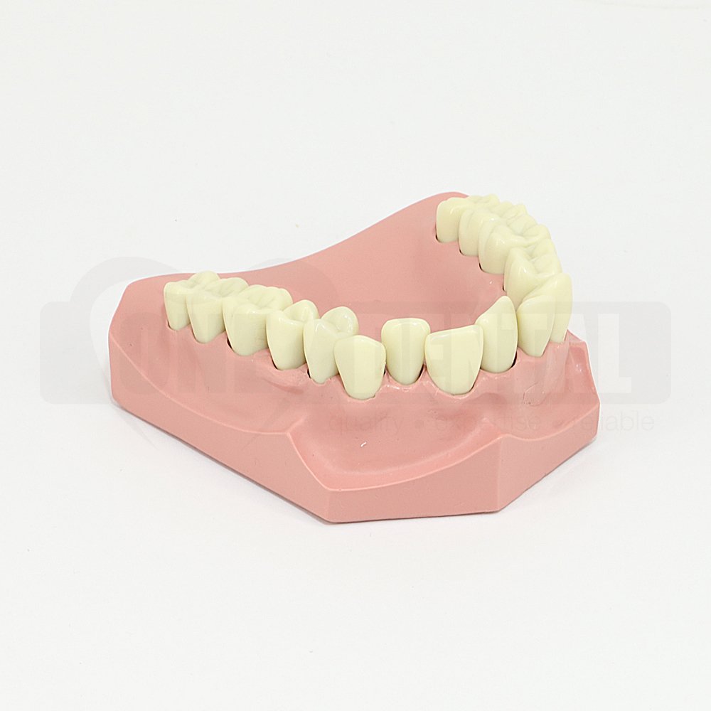 Ortho Model with crowded upper anteriors