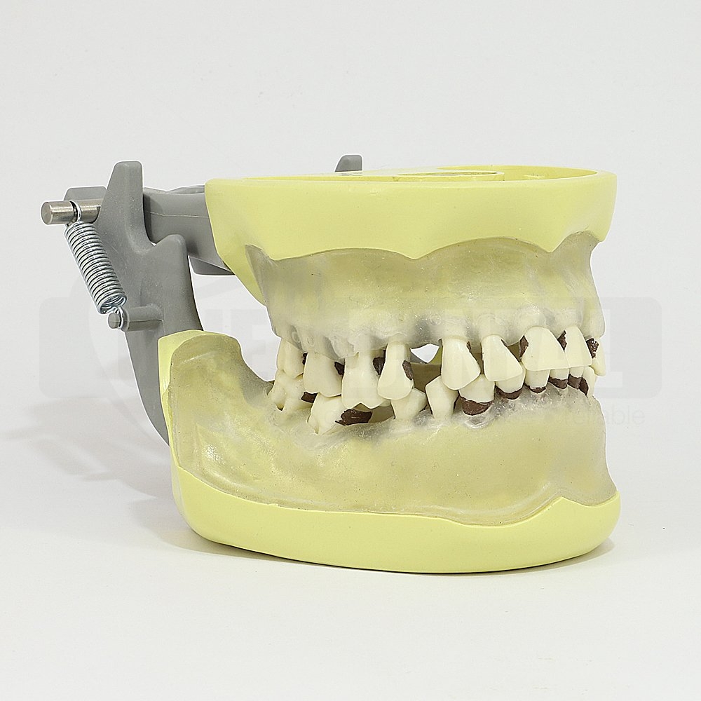 Adult Clear Gingiave Model for Perio & Extraction MQD (Bone)