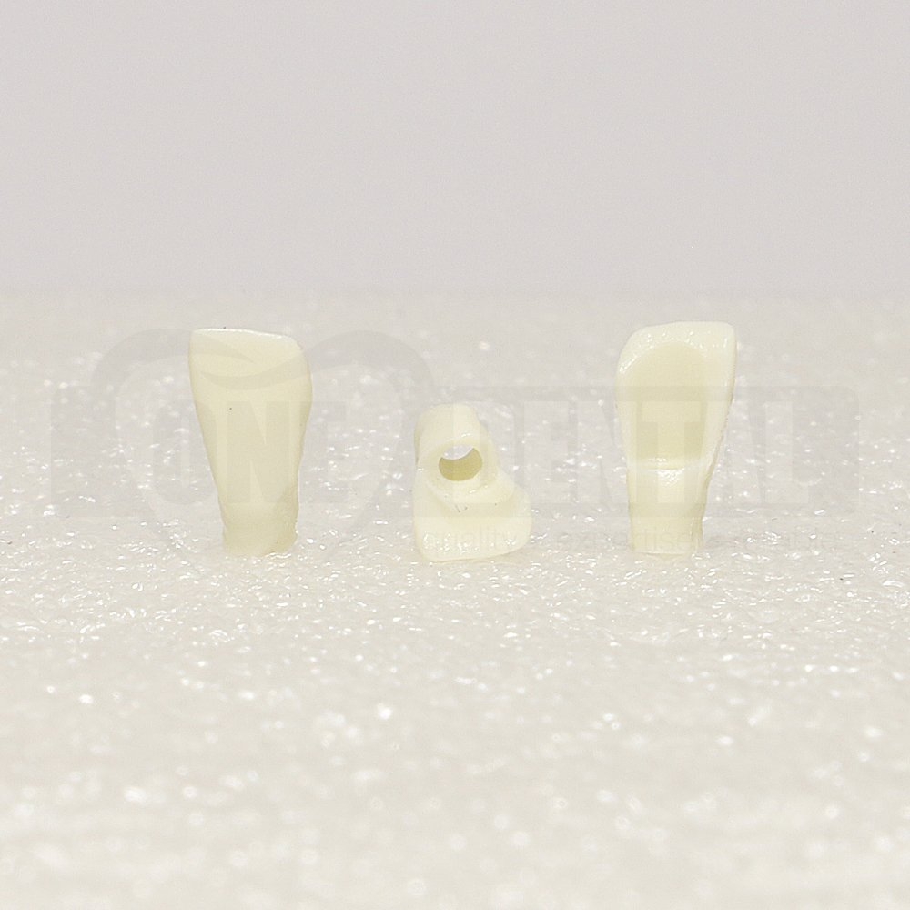 Periodontic Tooth 12 Crown