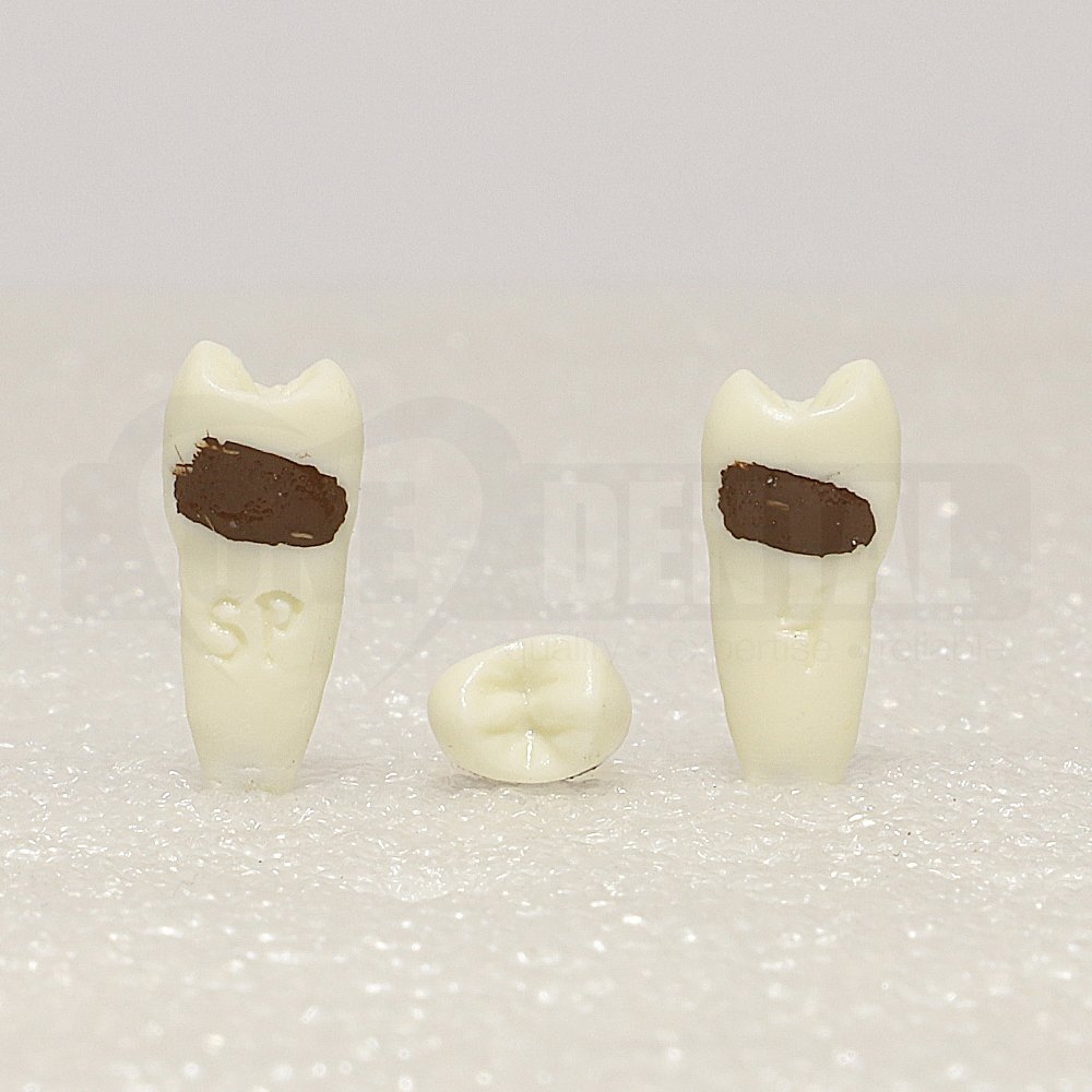 Periodontic Tooth 15 Spahr 19