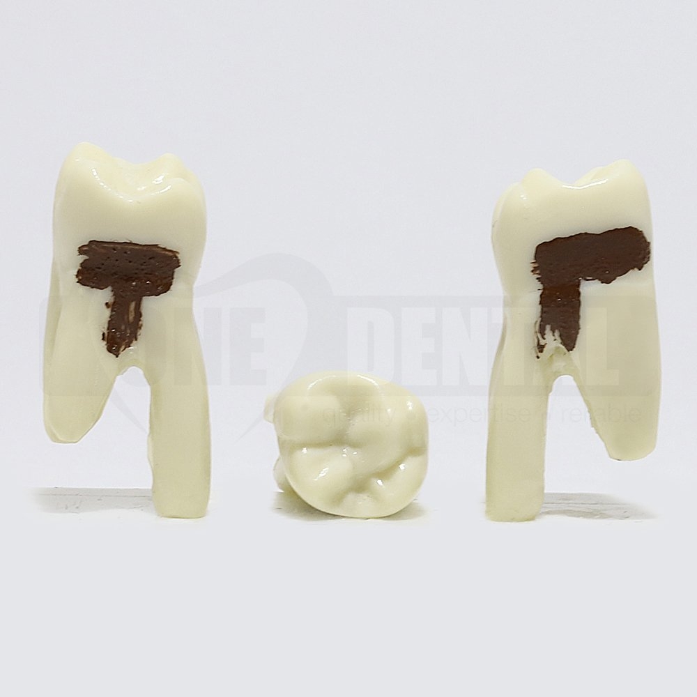 Periodontic Tooth 16