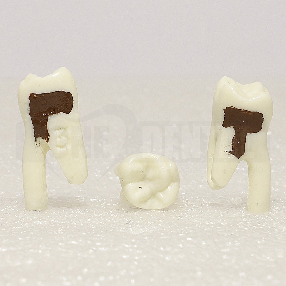 Periodontic Tooth 16 Spahr 2019
