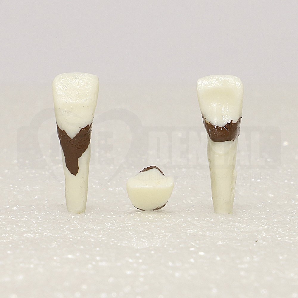 Periodontic Tooth 21 Spahr 19