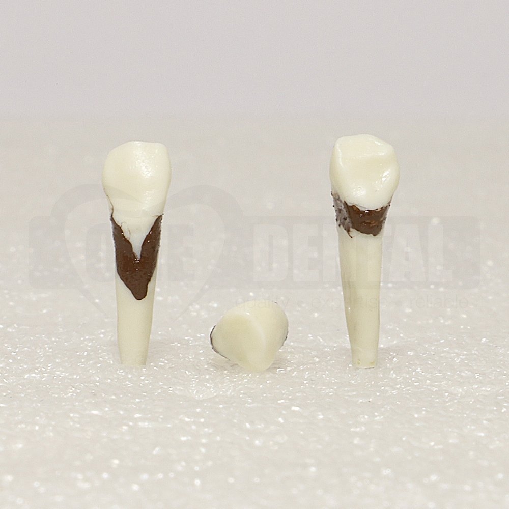 Periodontic Tooth 23 Spahr 19