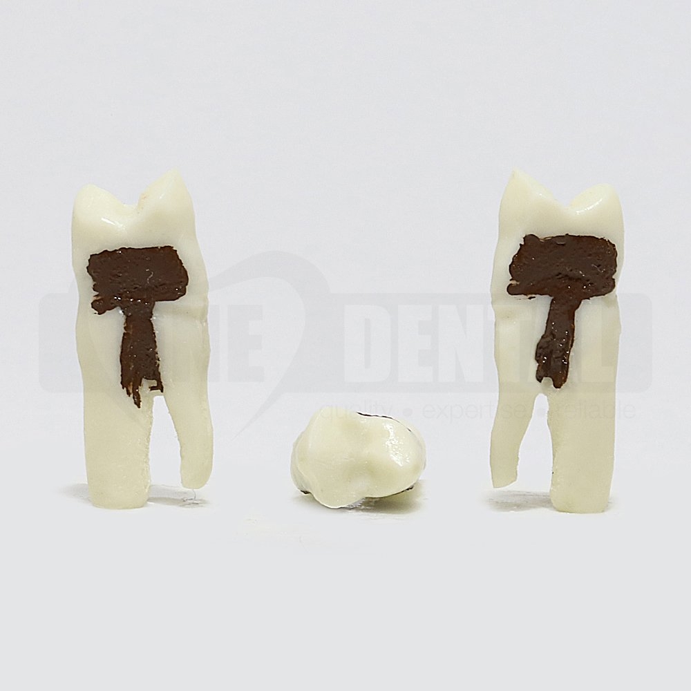 Periodontic Tooth 24