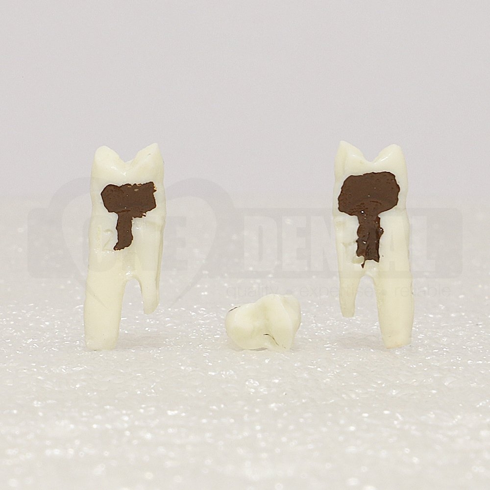 Periodontic Tooth 24 Spahr 19