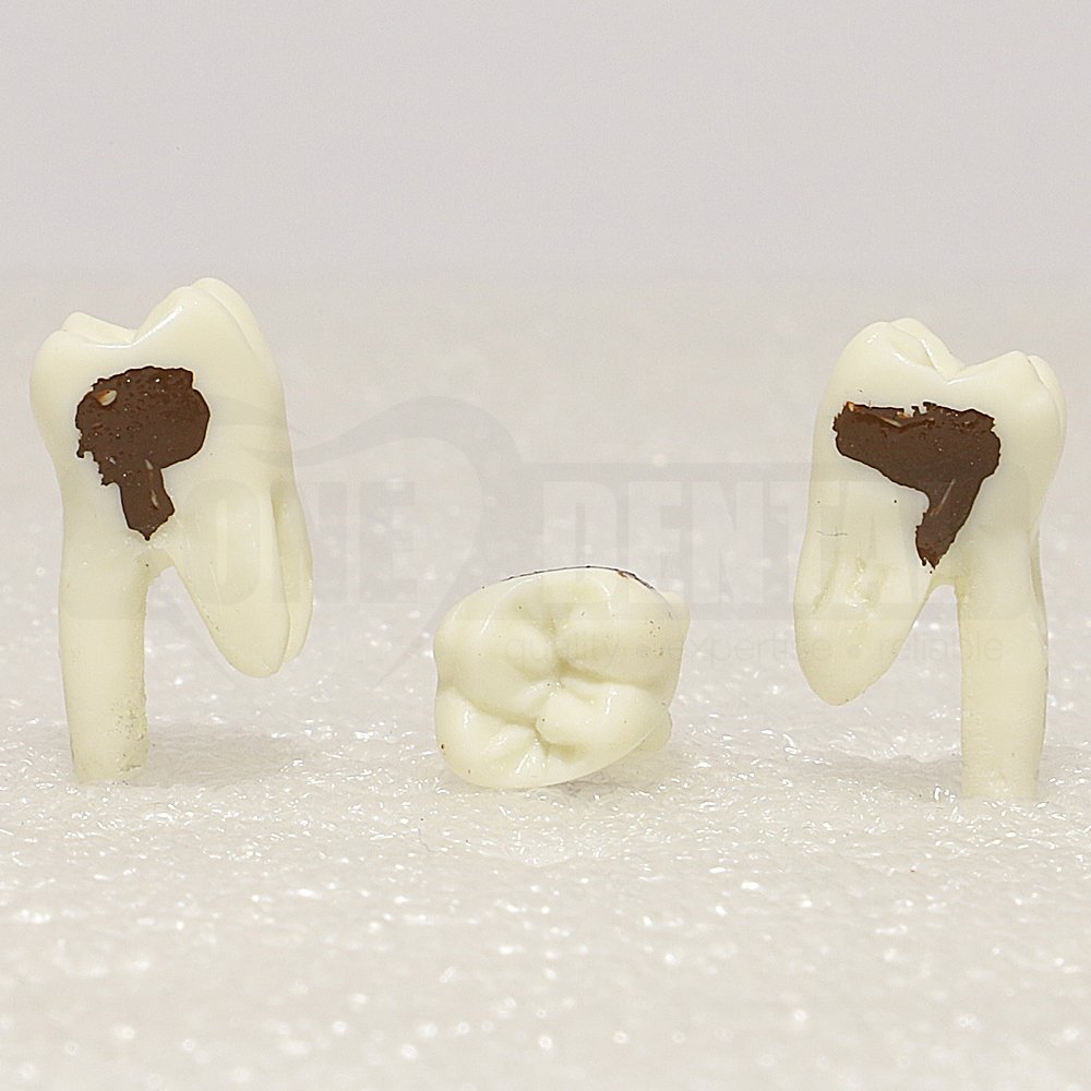 Periodontic Tooth 26 Spahr 19