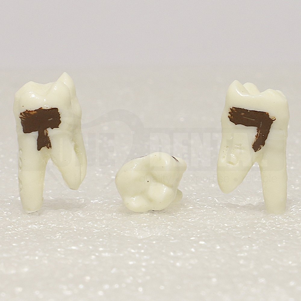 Periodontic Tooth 27 Spahr 19