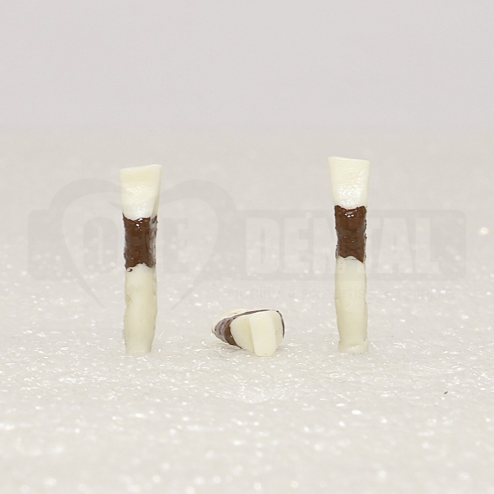Periodontic Tooth 31 Spahr 19