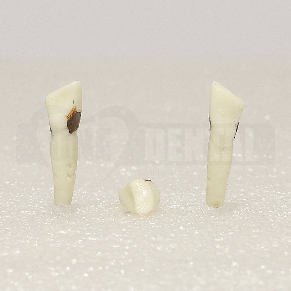 Periodontic Tooth 33 Spahr 19