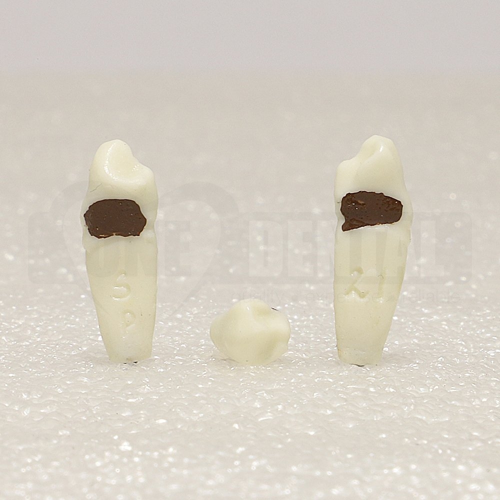 Periodontic Tooth 34 Spahr 19