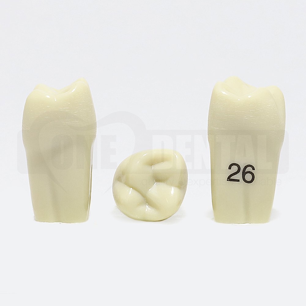 Tooth 26 for Paedo Model 1971