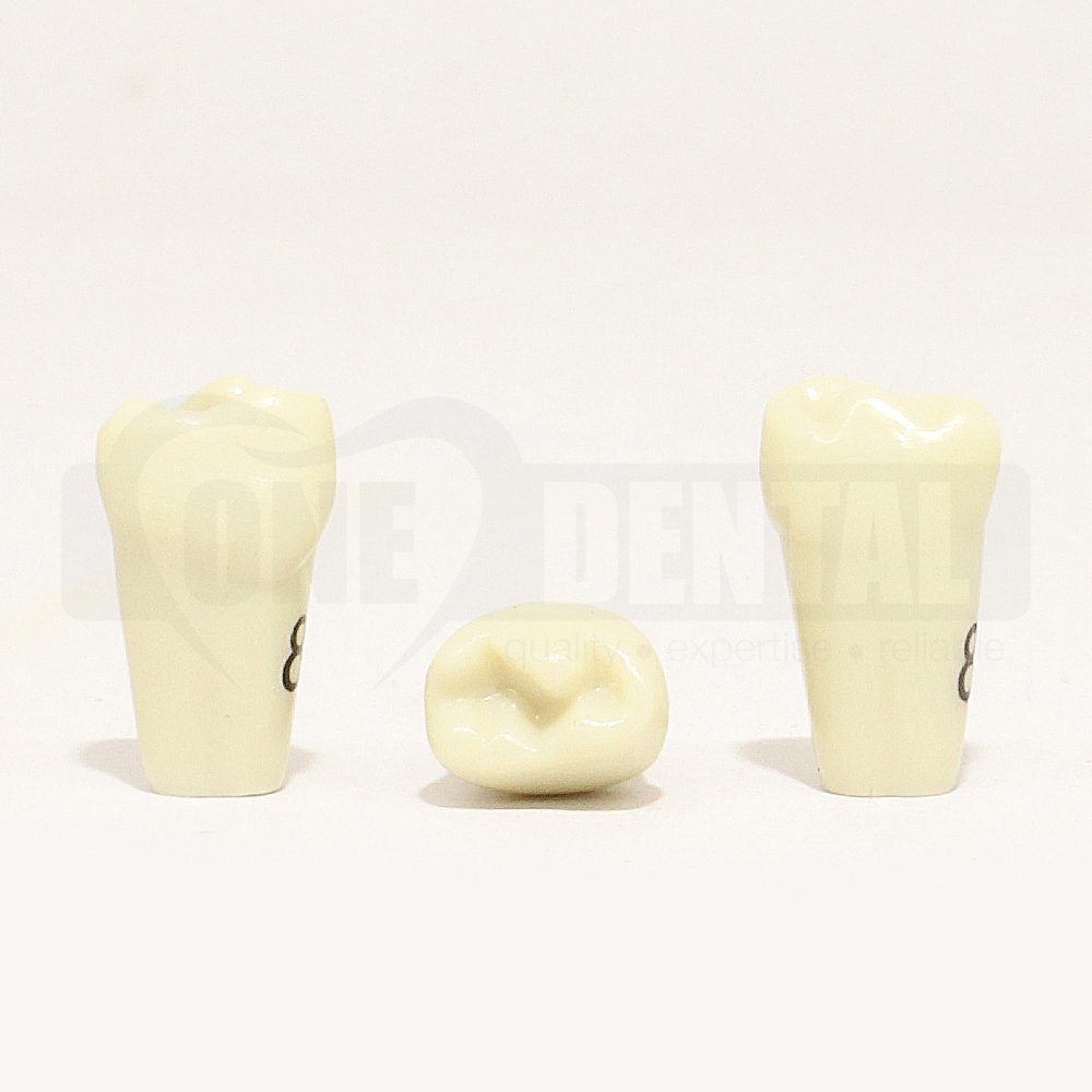 Tooth 84 for 1971 Paedo Model
