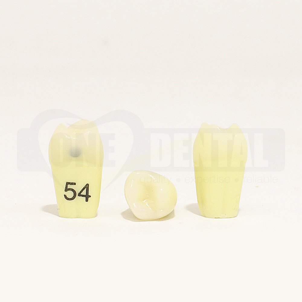 Caries Tooth 54 Mesial for 1971 Paedo Model