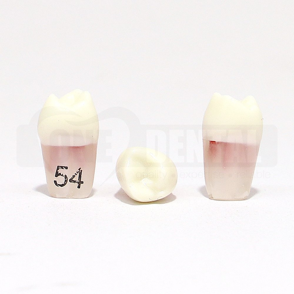 Pulpotomy Tooth 54 + screw for 1974 Paedo Model