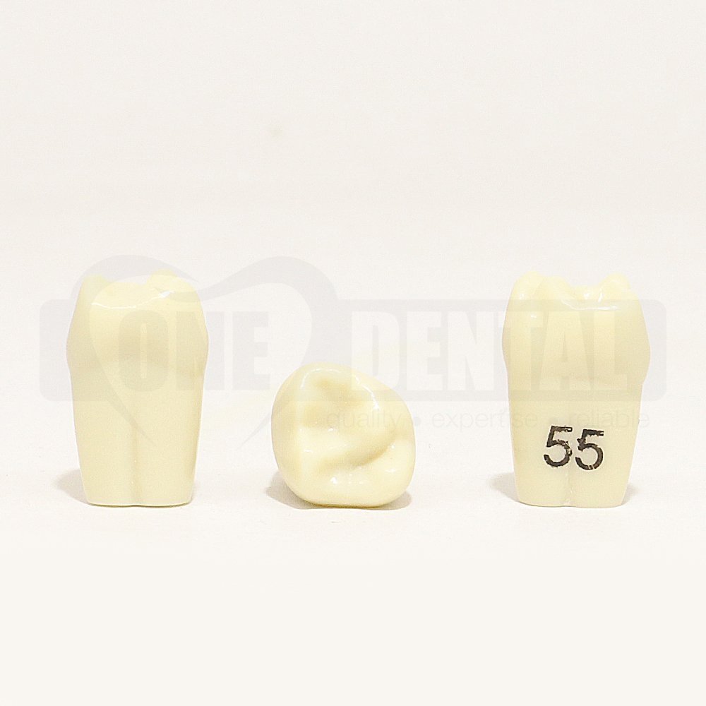 Tooth 55 for 1974 Paedo Model