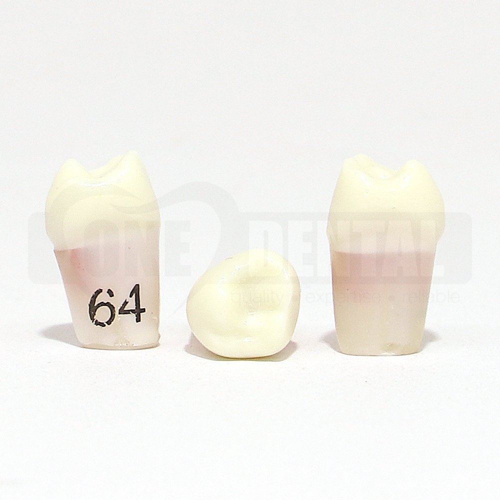 Pulpotomy Tooth 64 + Screw for 1974 Paedo Model