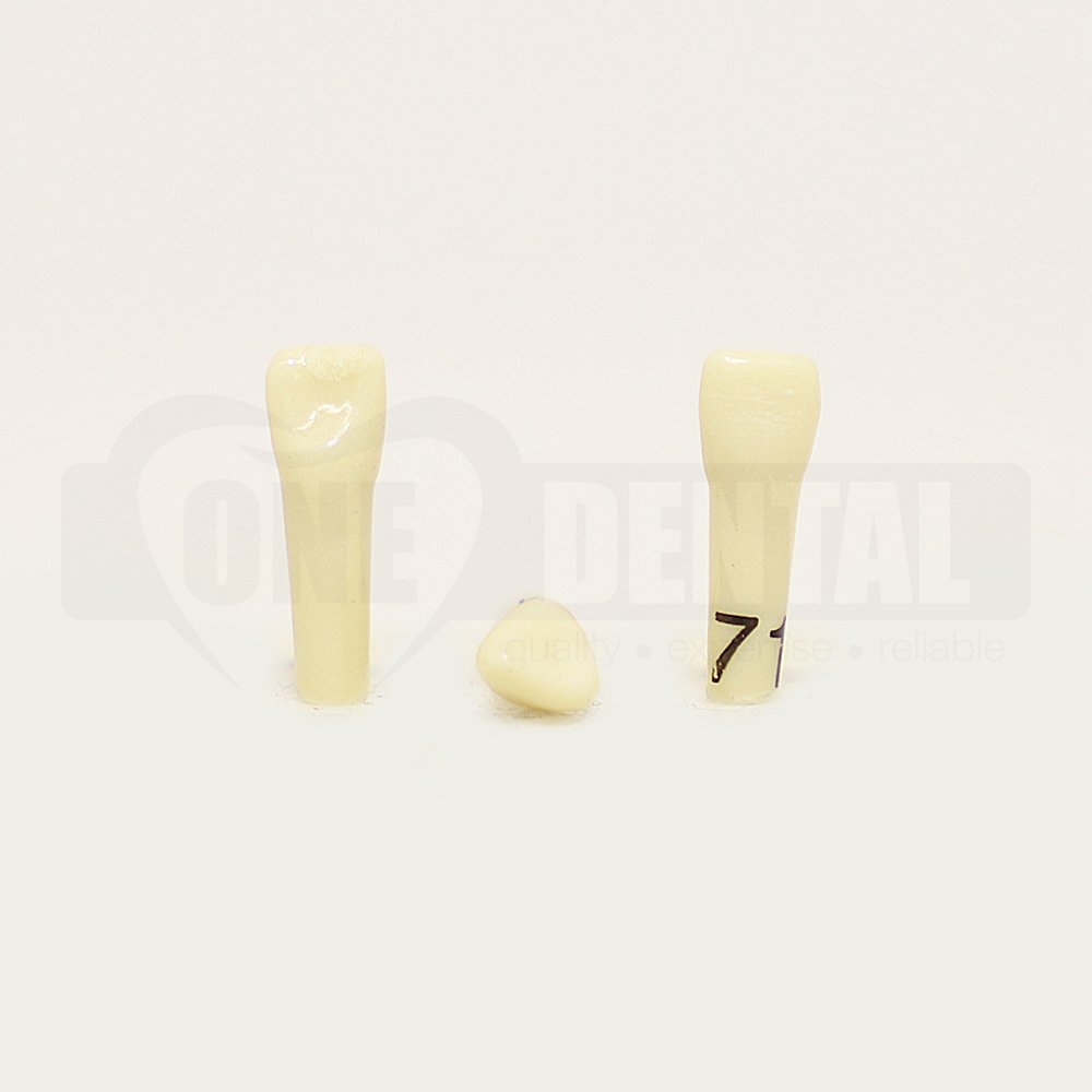 Tooth 71 for 1974 Paedo Model