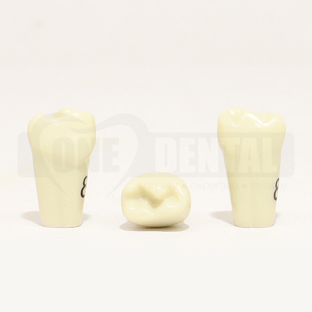Tooth 84 for 1974 Paedo Model