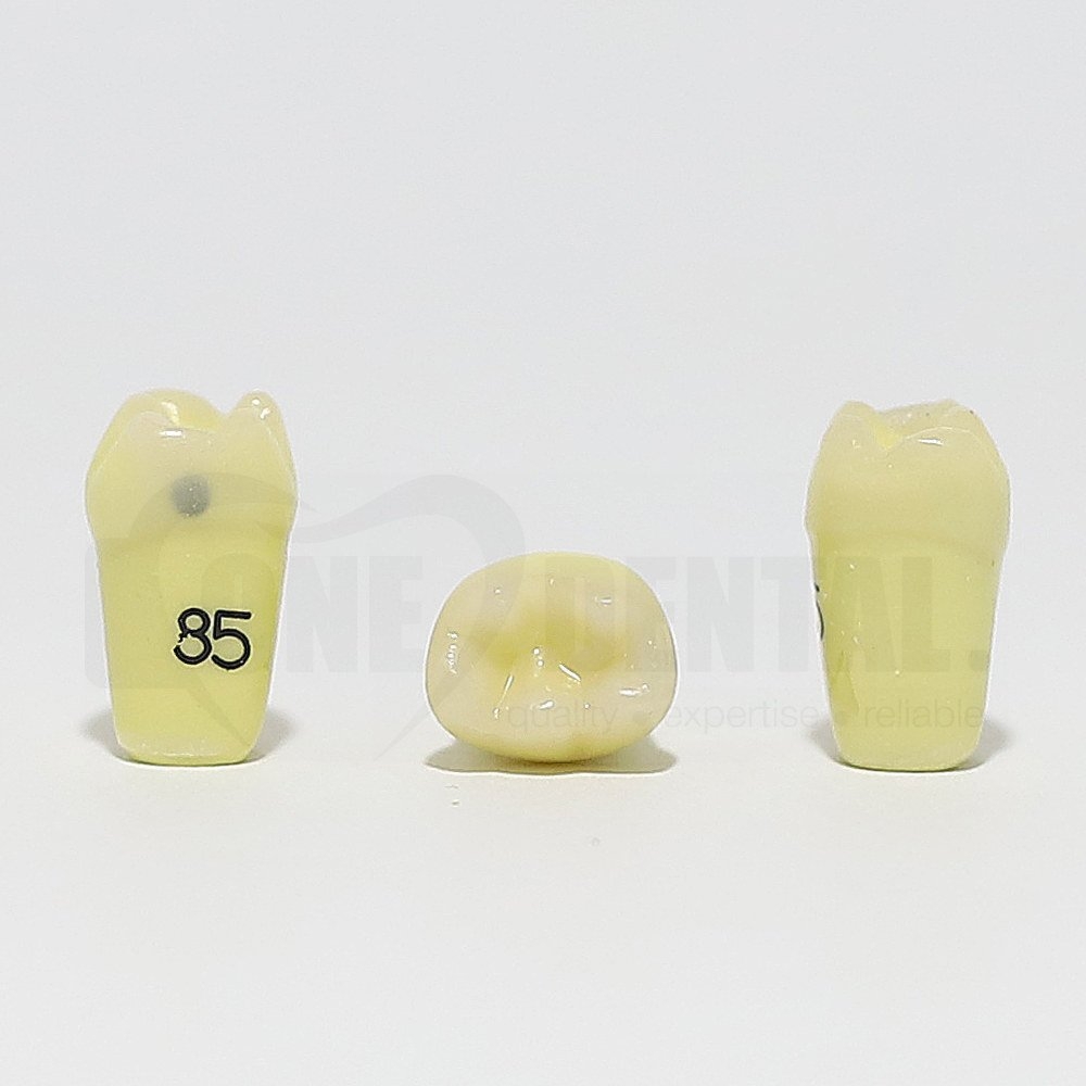 Caries Tooth 85 Mesial for 1974 Paedo Model
