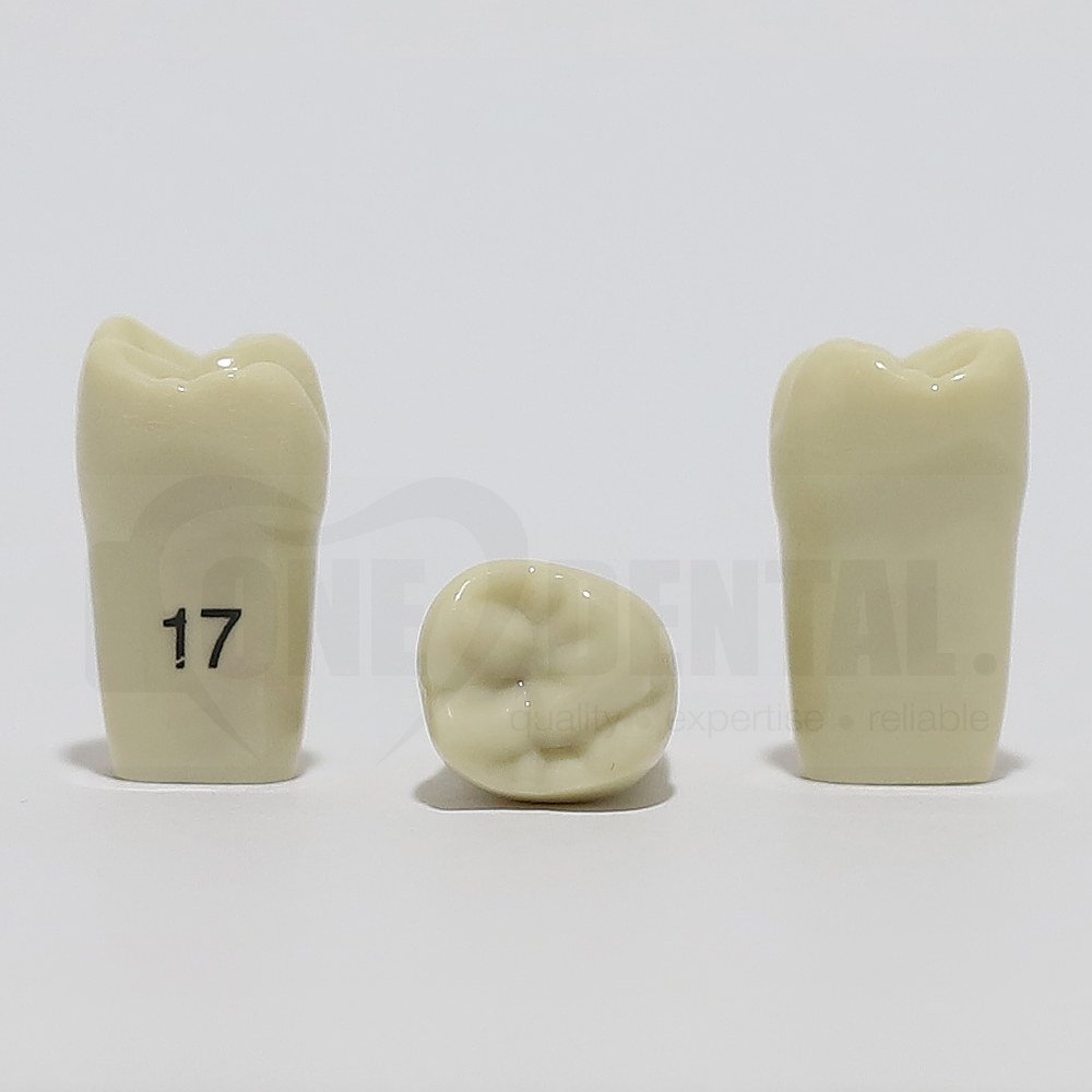 Tooth 17 for 2008 Adult Model