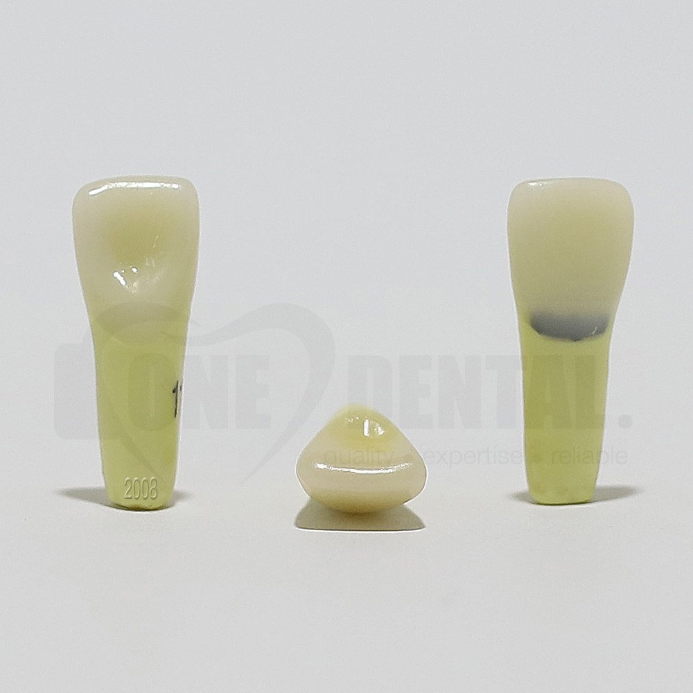 Caries Tooth 11 Cervical for 2008 Adult Model