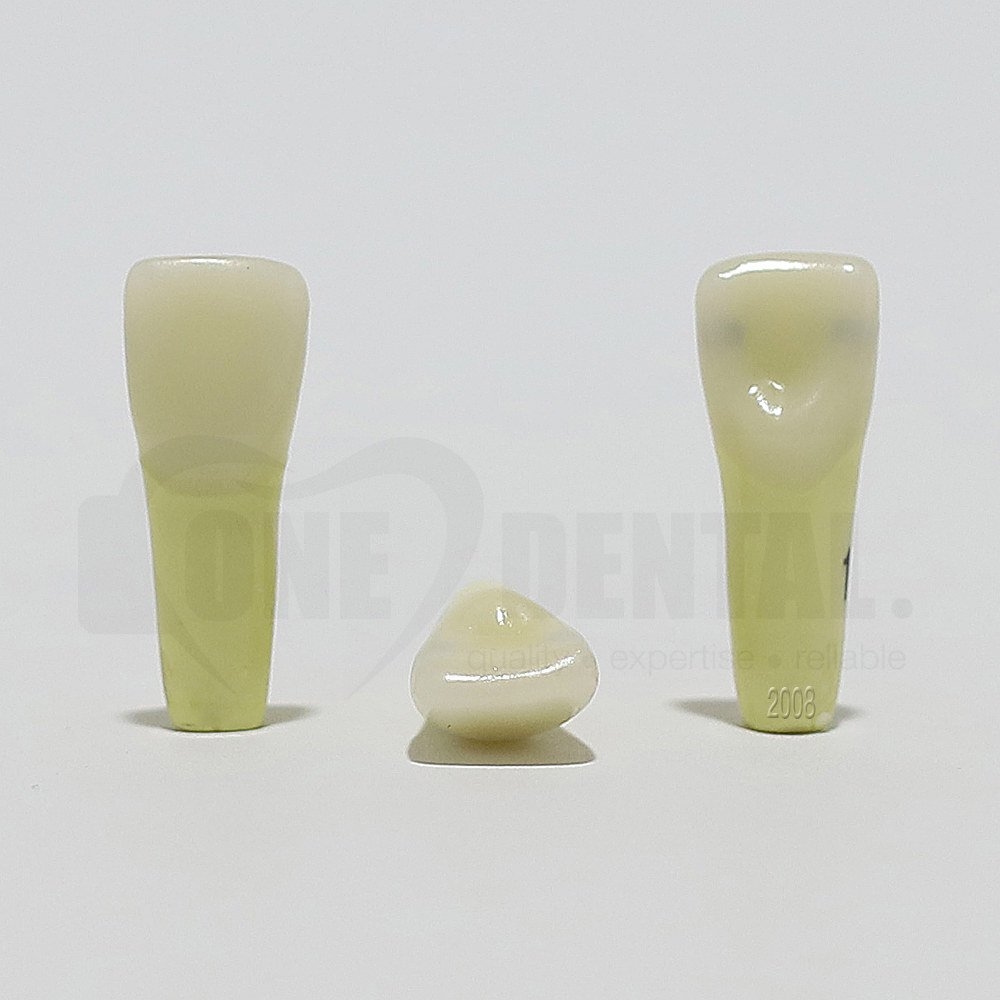 Caries Tooth 11 MD for 2008 Adult Model