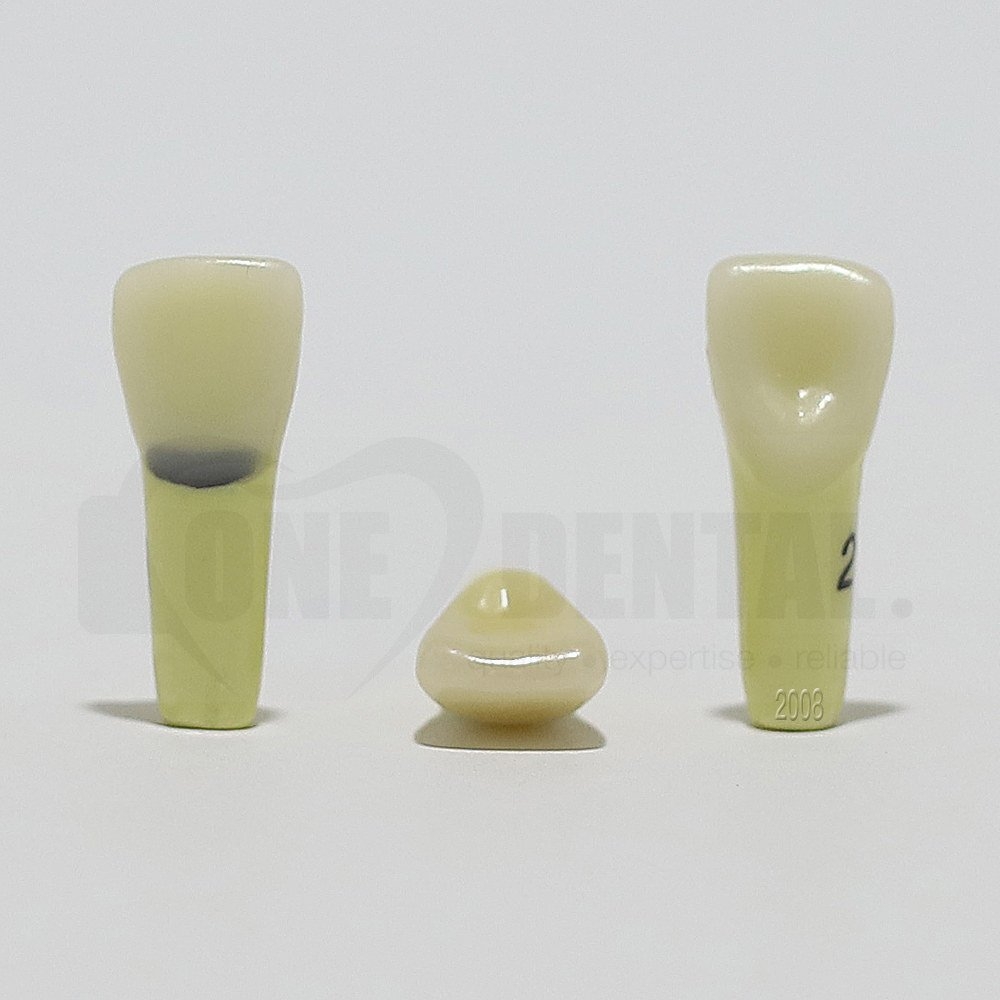 Caries Tooth 21 Cervical for 2008 Adult Model