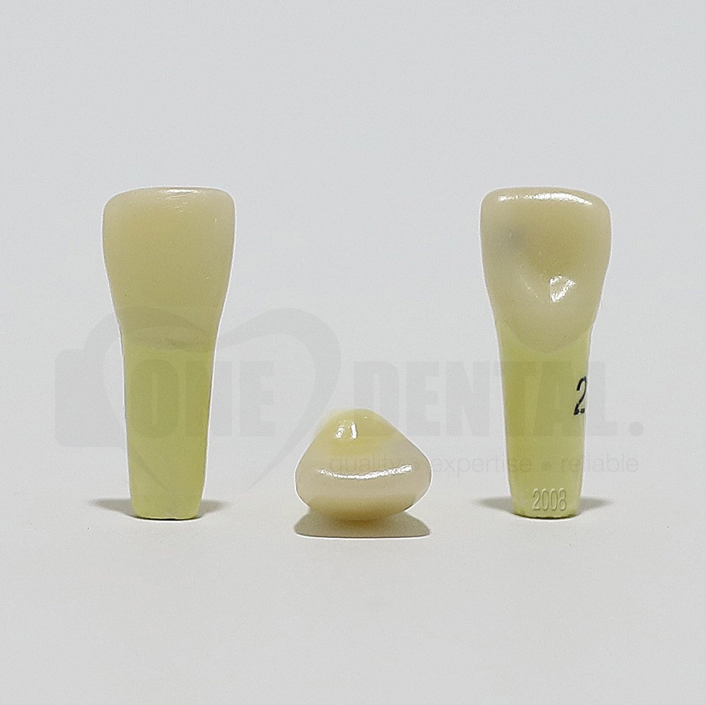 Caries Tooth 21M for 2008 Adult Model
