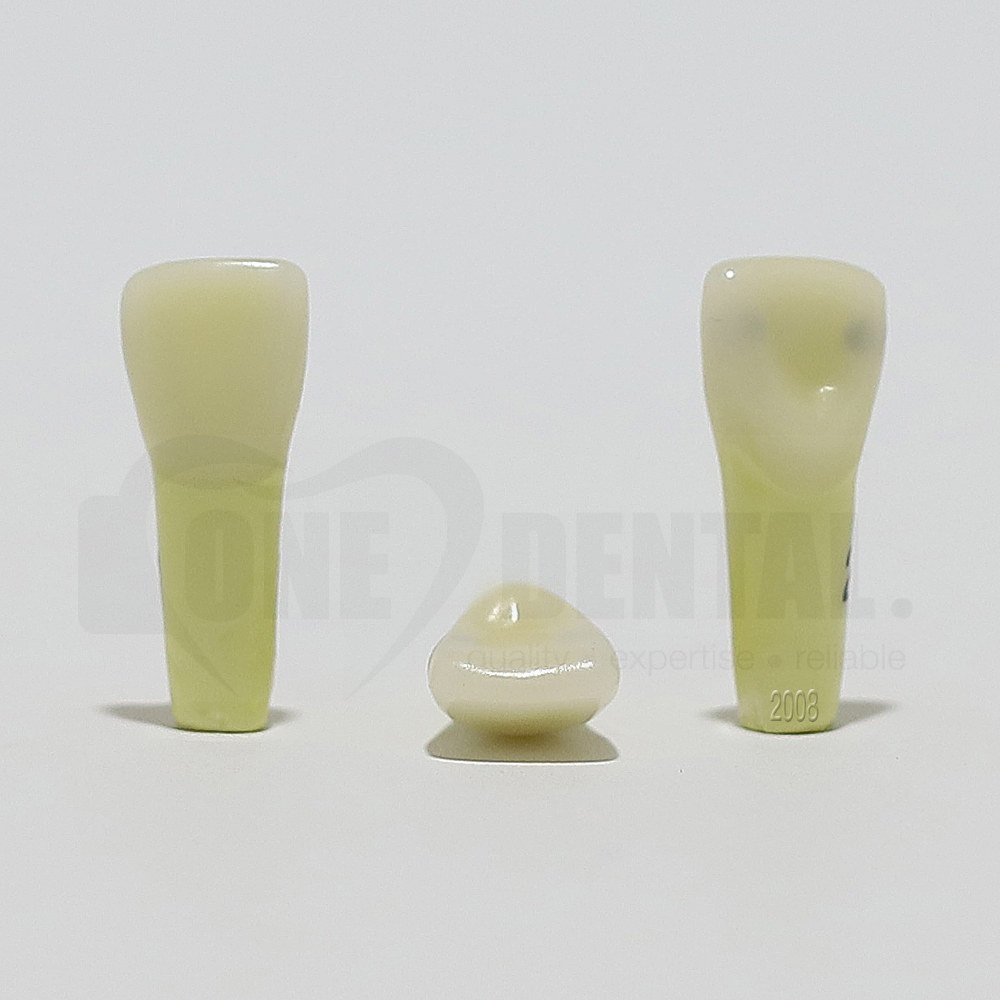 Caries Tooth 21 MD for 2008 Adult Model