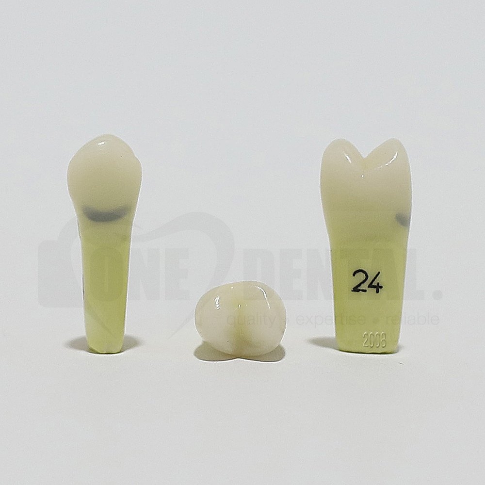 Caries Tooth 24 Cervical for 2008 Adult Model