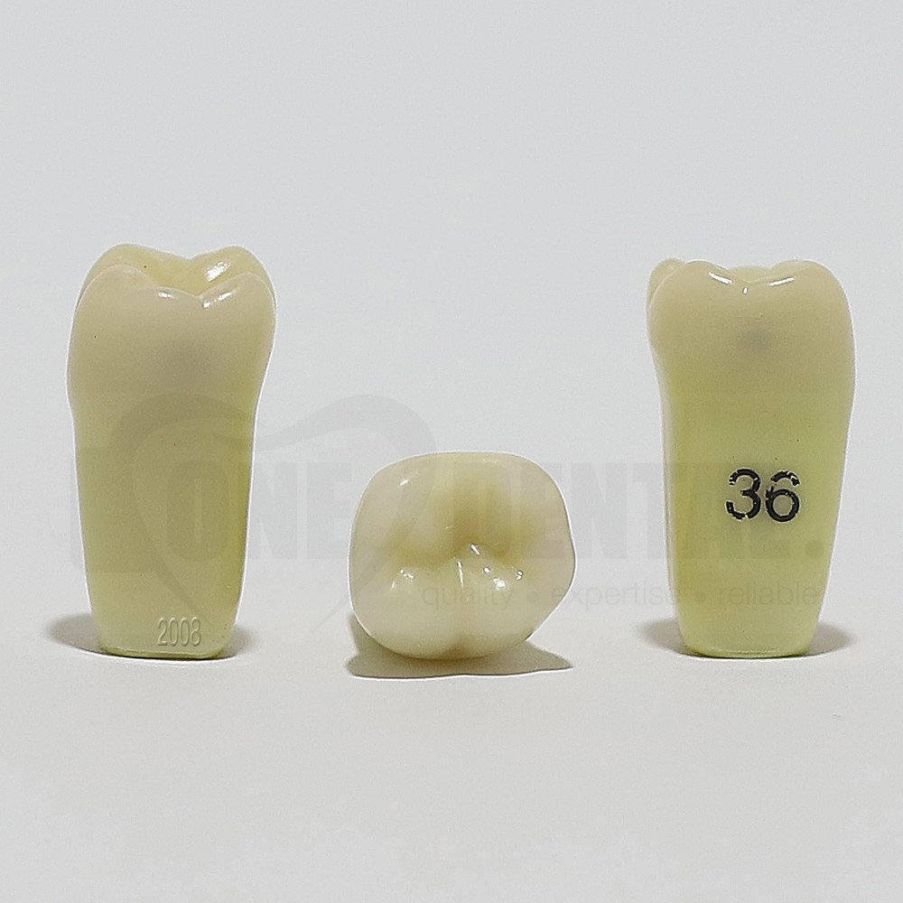 Caries Tooth 36 M+D for 2008 Adult Model