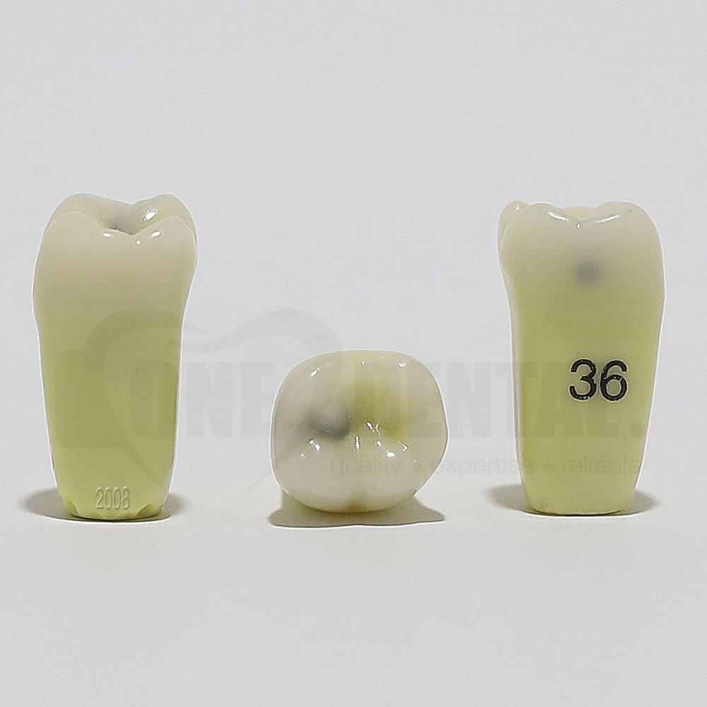 Caries Tooth 36MO for 2008 Adult Model