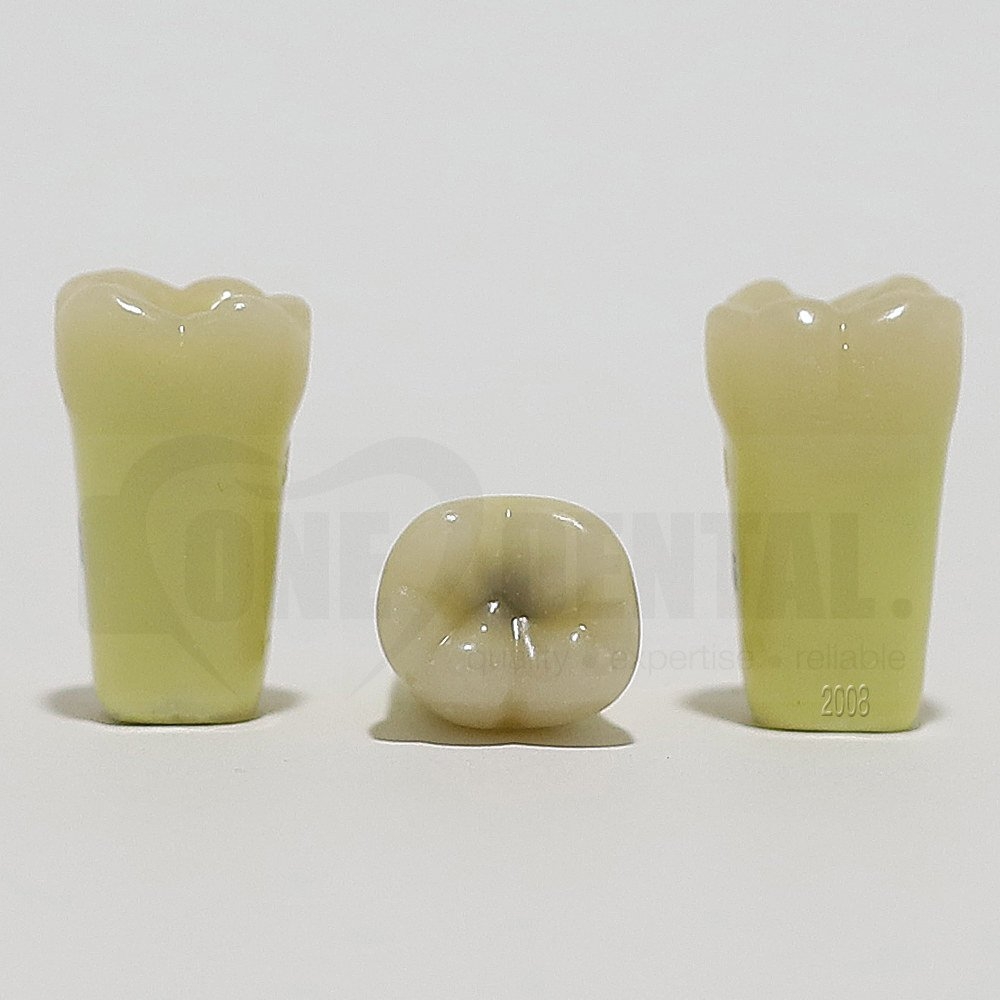 Caries Tooth 46 Occ for 2008 Adult Model