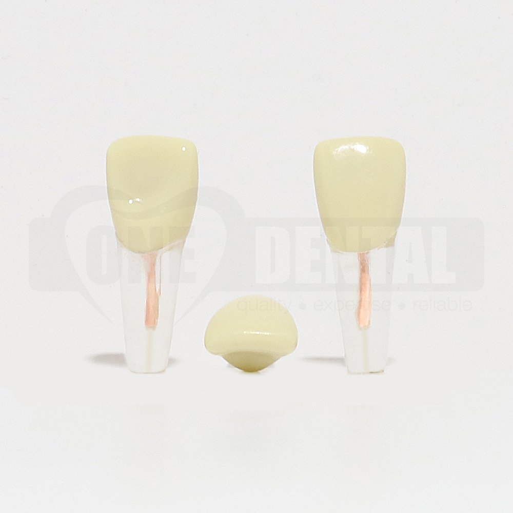 Tooth 11 Endo Gutta Percha Filled No Crown for 2008 Adult Model