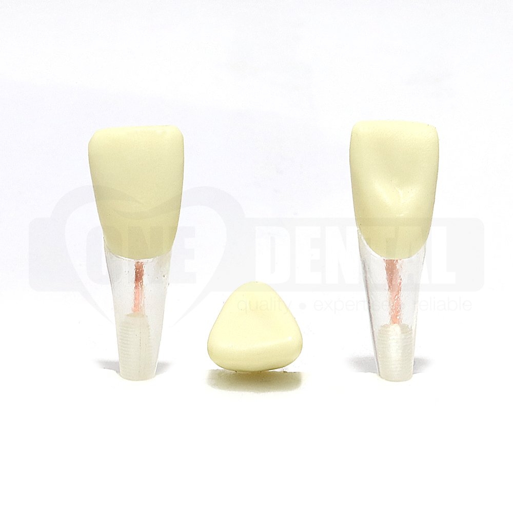 Tooth 21 Endo Gutta Percha Filled with Crown for 2008 Adult Model