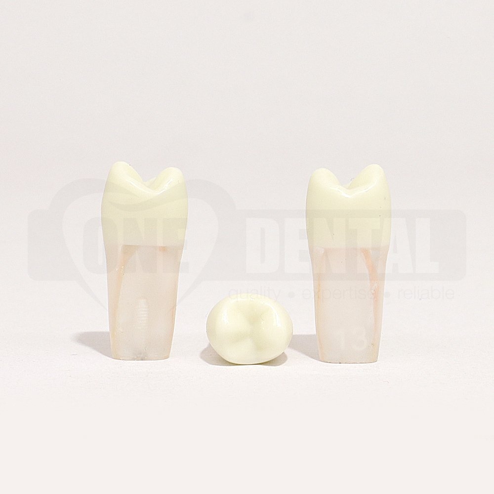 Tooth 25 Endo Gutta Percha Filled for 2008 Adult Model