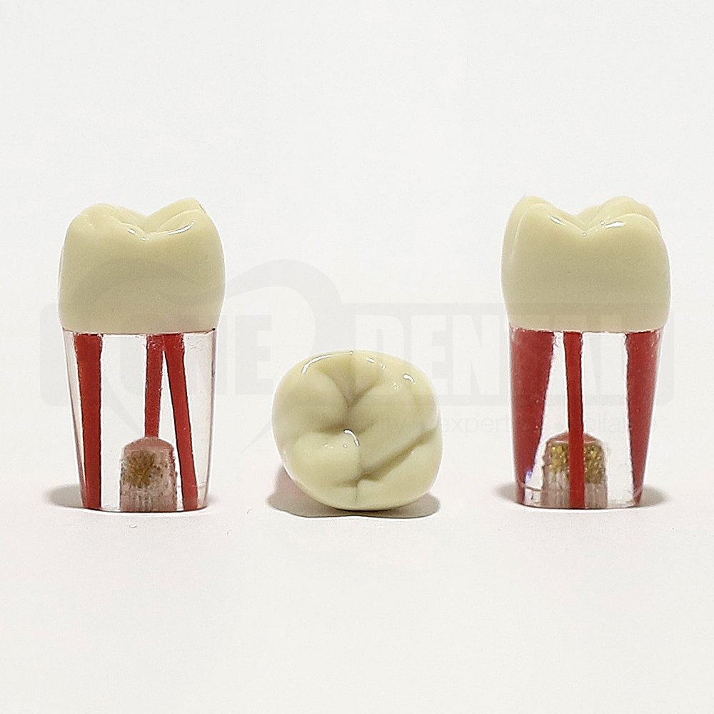 Endo Tooth 16 for 2008 Adult Model