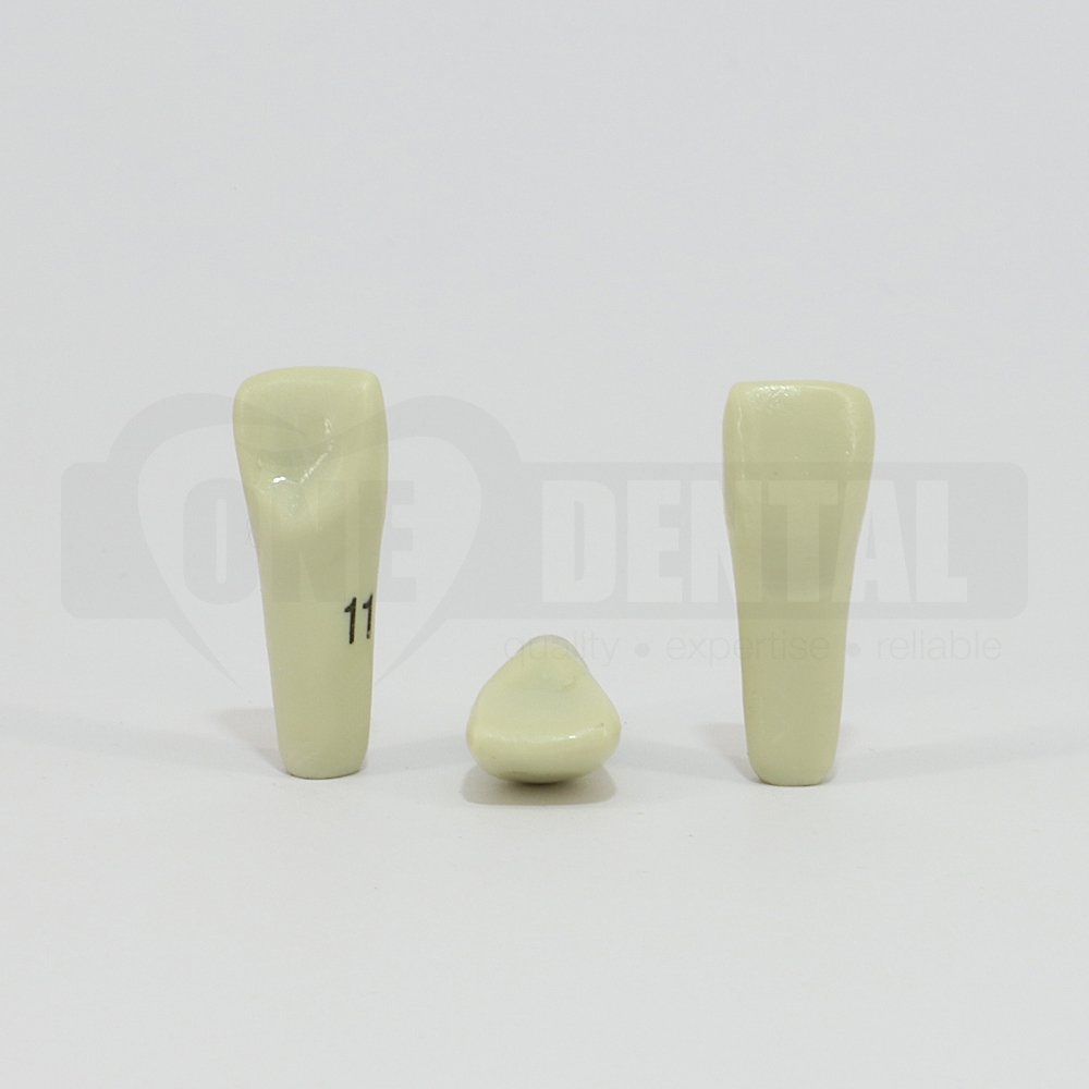 Prep Tooth 11 Diastema for 2008 Adult Model
