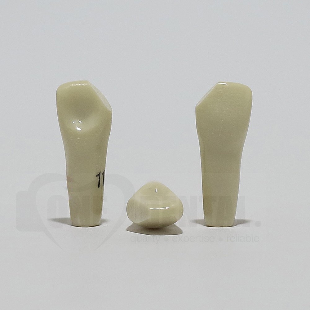 Tooth 11 Mesial Fracture for 2008 Adult Model