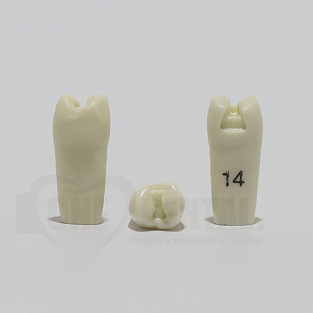 Prep Tooth 14DO for 2008 Adult Model