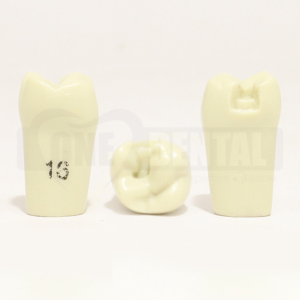 Prep Tooth 16MO for 2008 Adult Model