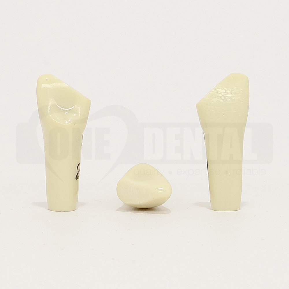Prep Tooth 21 Distal Fracture PC for 2008 Adult Model