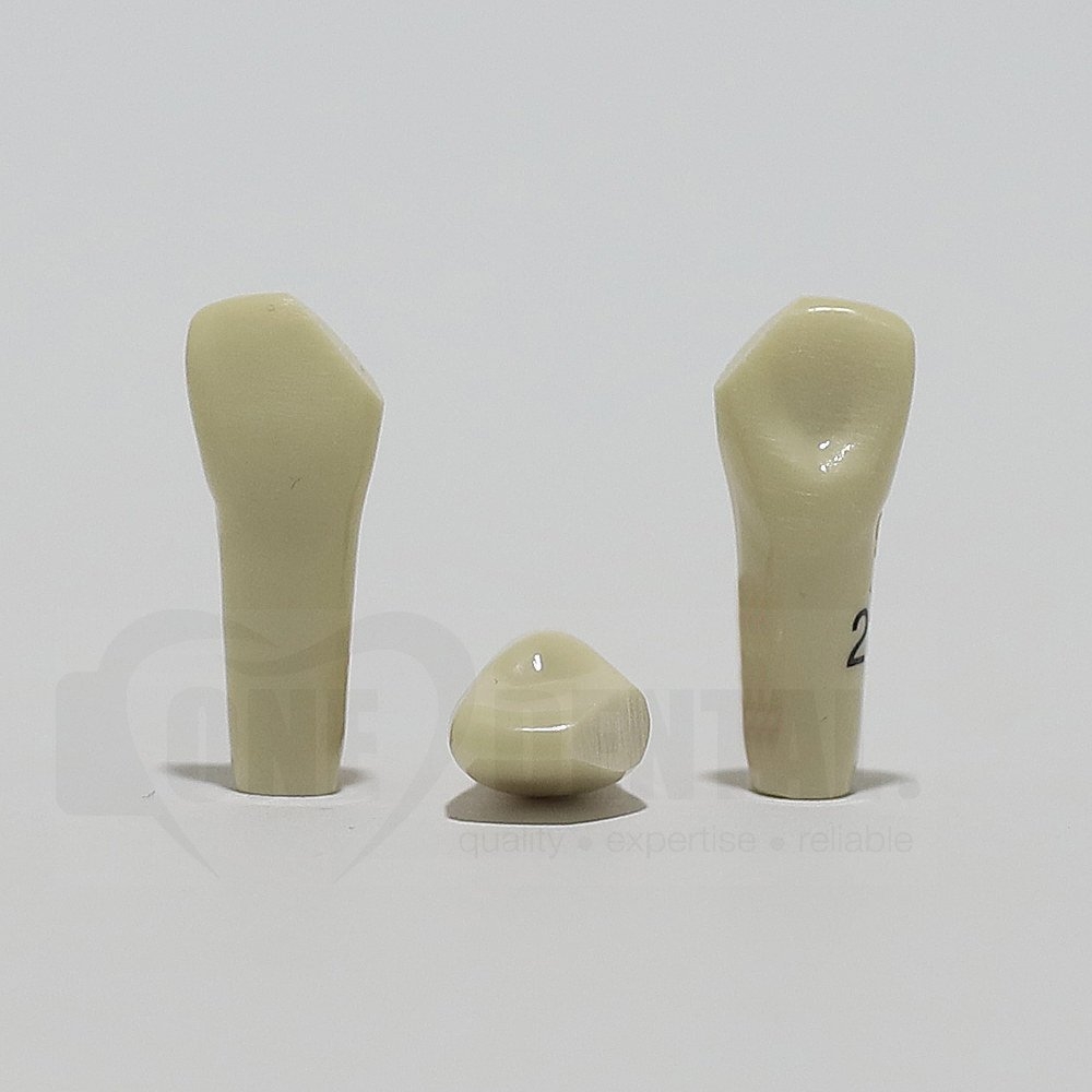 Prep Tooth 21 Mesial Fracture for 2008 Adult Model