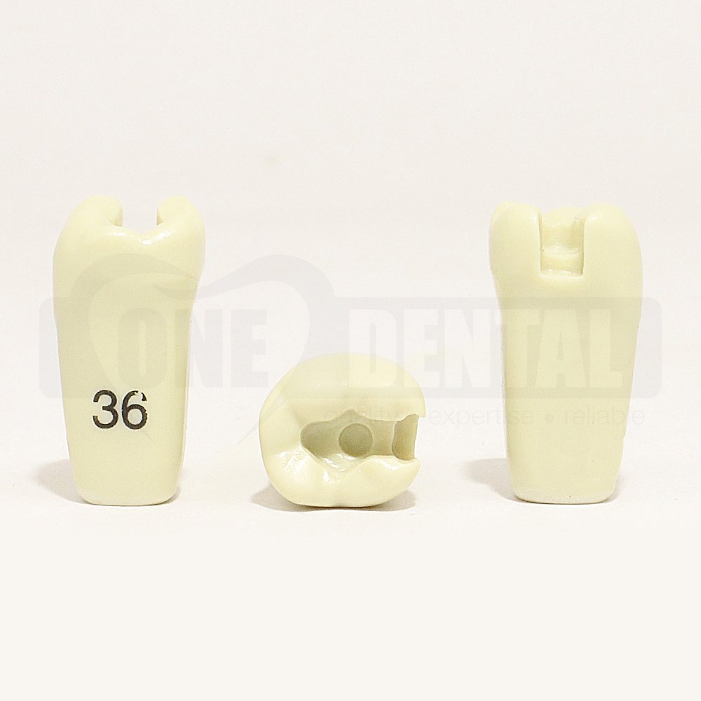 Prep Tooth 36MO for 2008 Adult Model