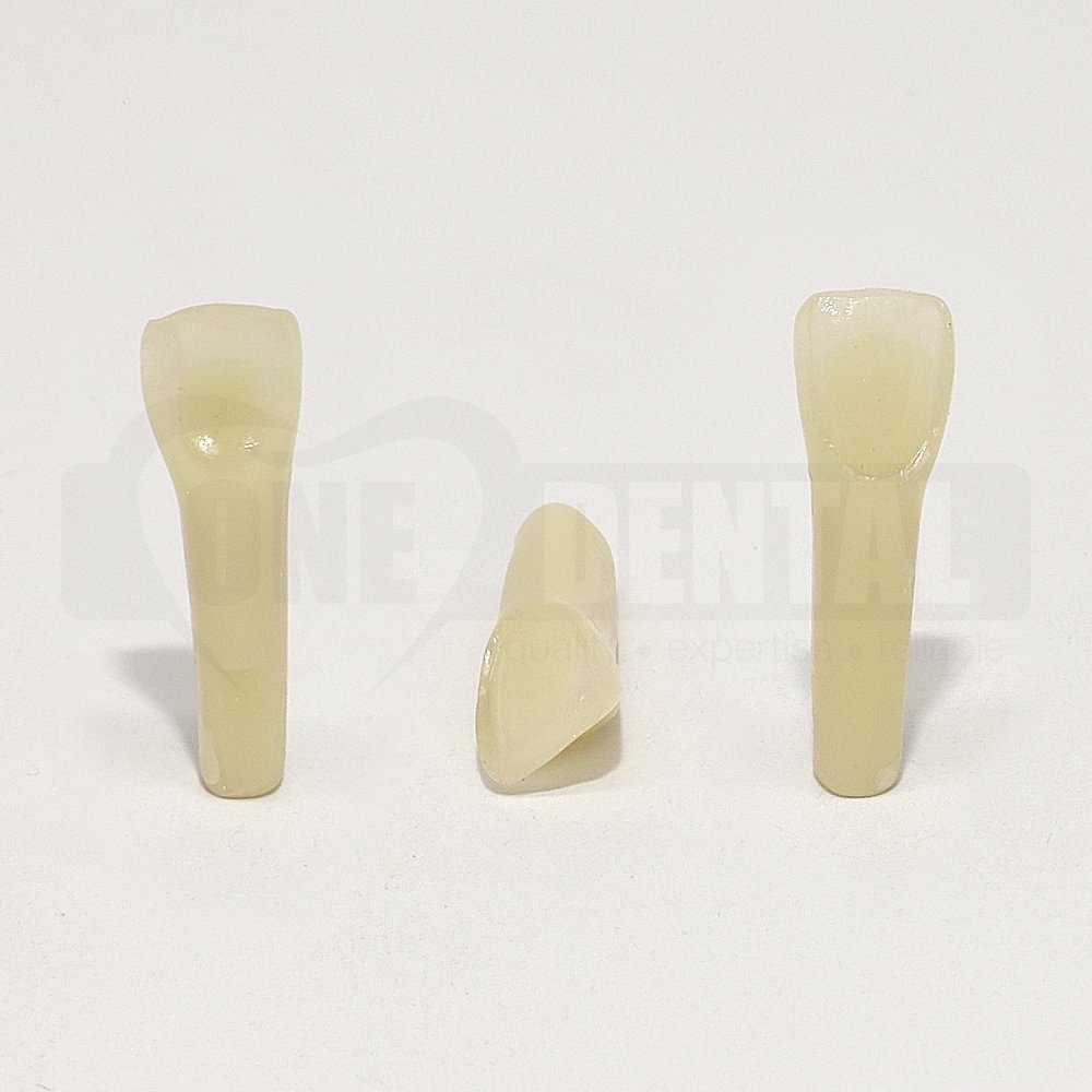 Aesthetic Tooth 12 Veneer Prep for 2010 Adult Model