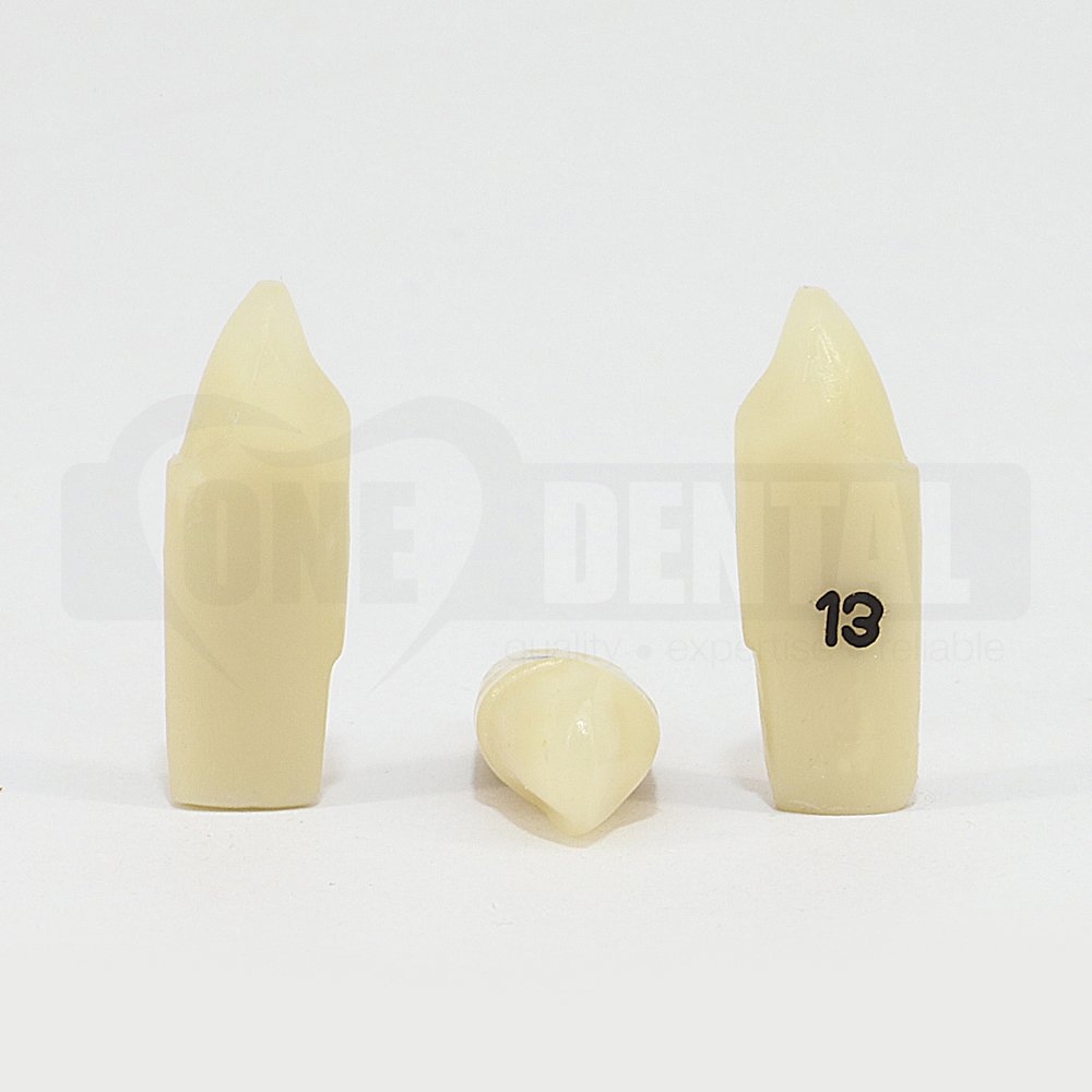 Aesthetic Tooth 13 Veneer Prep for 2010 Adult Model