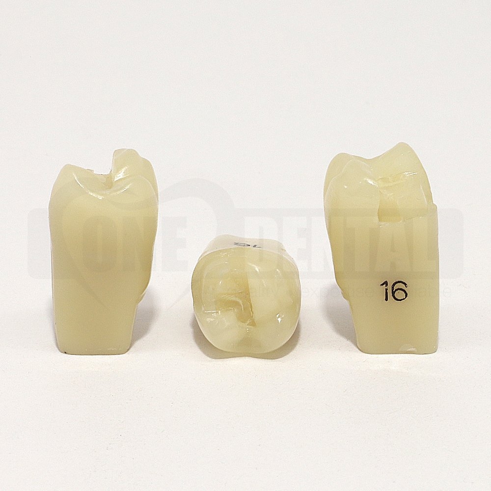Aesthetic Tooth 16MOB for 2010 Adult Model
