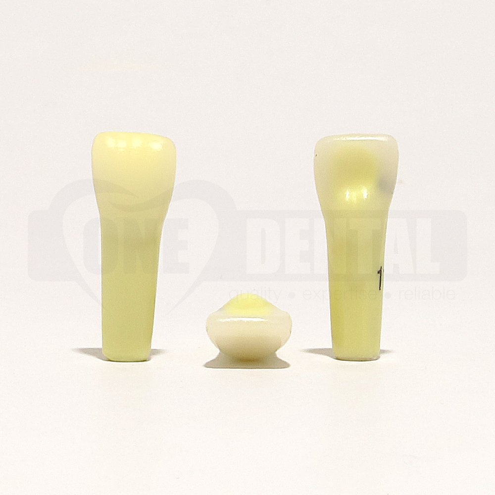 Caries Tooth 11 Mesial for 2010 Adult Model